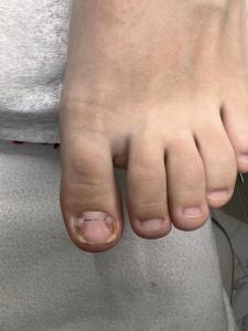 Фотография DermaFeet 4