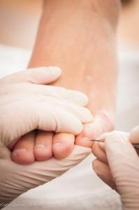 Фотография DermaFeet 3