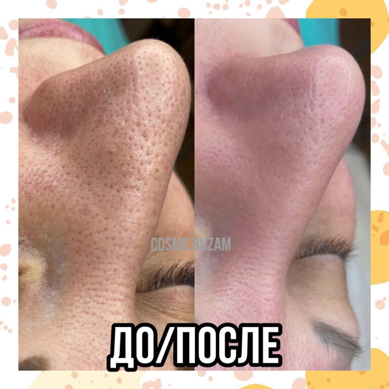 слайд