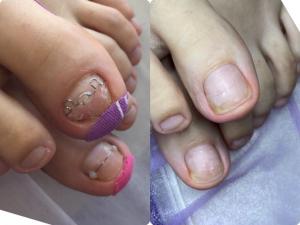 Фотография Lucky Pedicure. Кабинет подолога 4