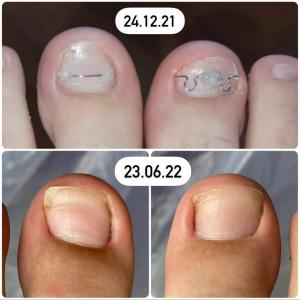 Фотография Lucky Pedicure. Кабинет подолога 5