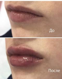 Фотография Ника 5