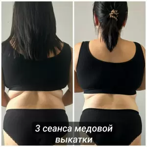 Фотография Elen Beauty 4