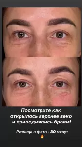 Фотография Pro Брови 5
