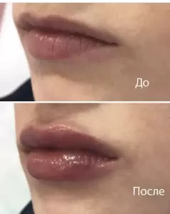 Фотография Ника 5